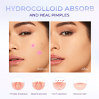 Multi-shaped Pimple Patches