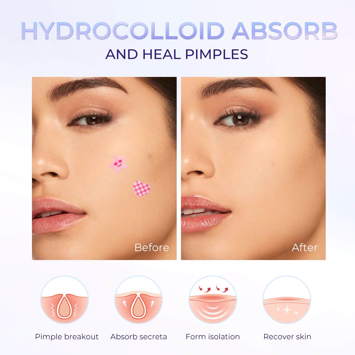 SACE LADY  Pimple Patches